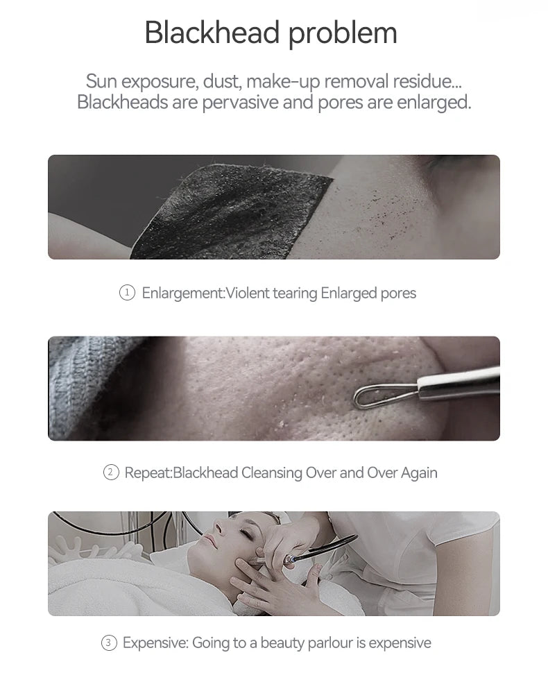 Vacuum Acne Cleaner Electric Blackhead Remover Black Head Removal Facial Deep Cleansing Pore Cleaner Machine Skin Care Tools