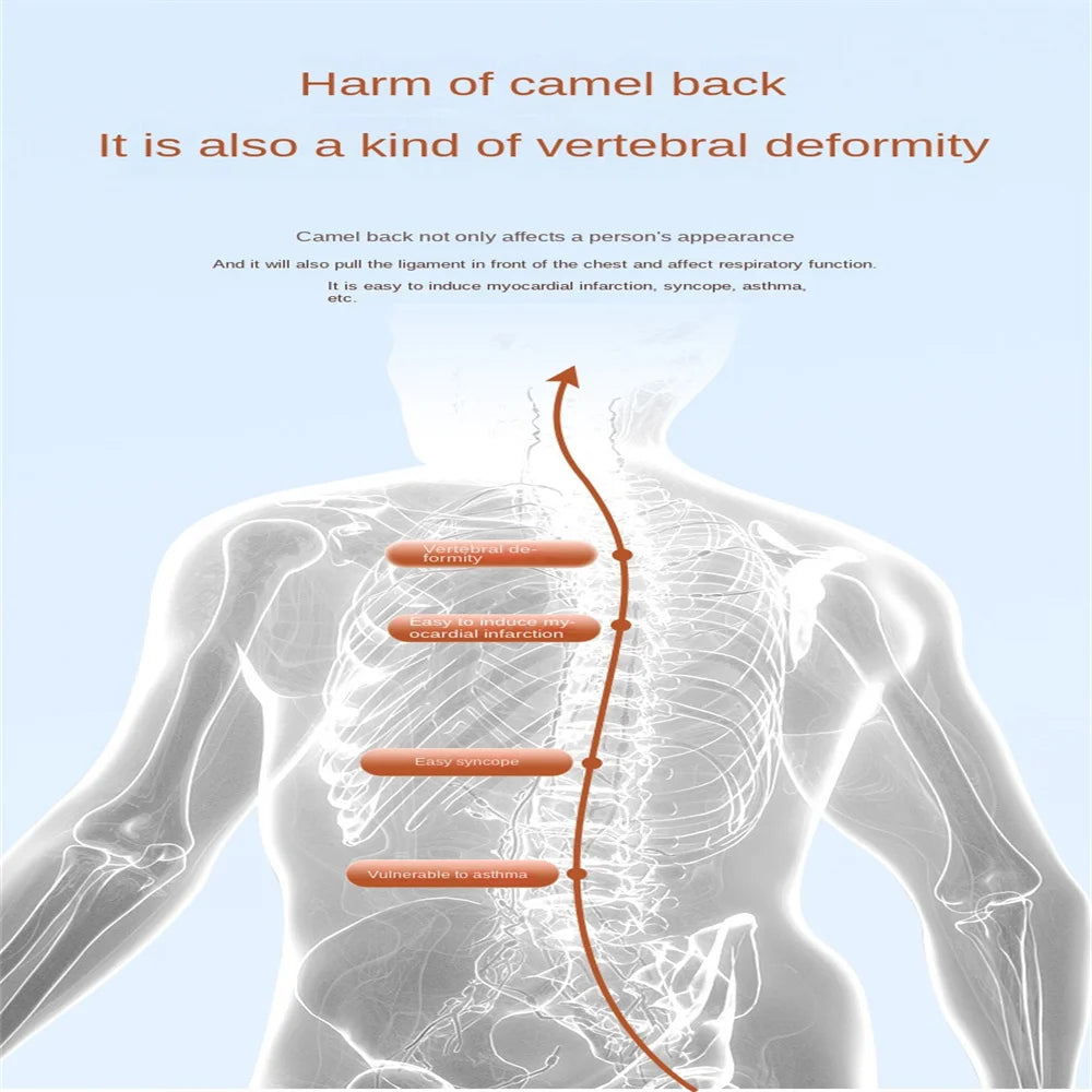 Smart Back Posture Corrector