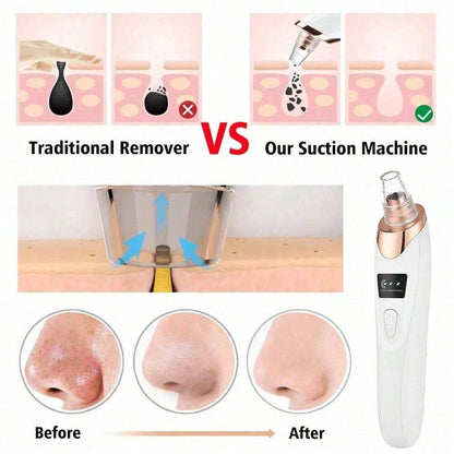 FLEXSAC™ – Electric Acne Pore Cleaner & Blackhead Remover