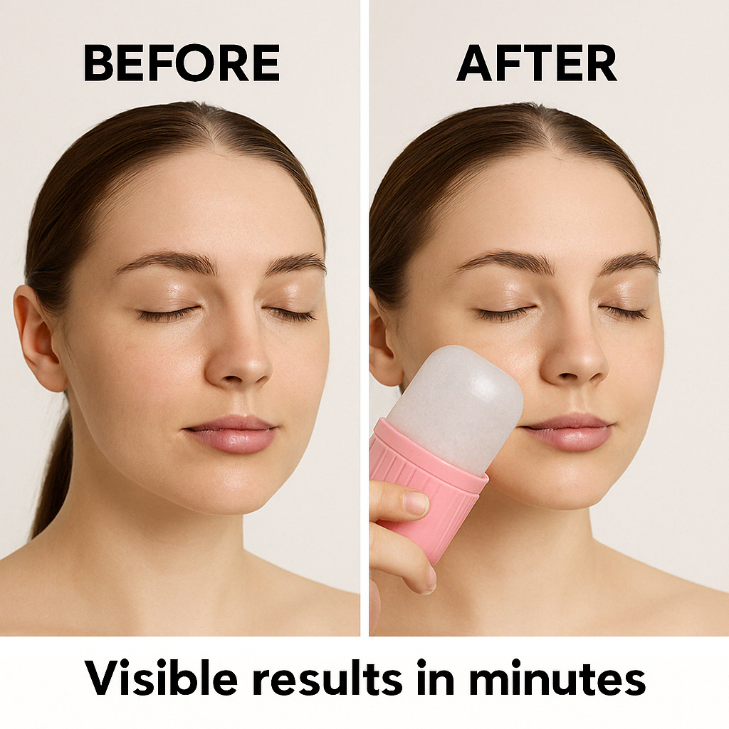 FLEXSAC™-Ice Face Roller