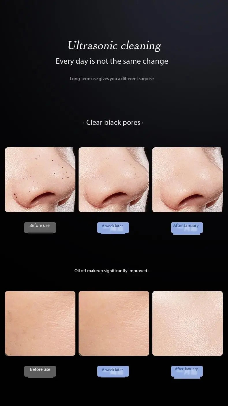 Blackhead Remover Blackhead Cleaning Pore Shrinking Beauty Device Dead Skin Acne Scalper Facial Pore Cleanser
